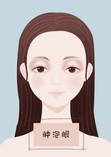 浮肿运动后消失是怎么事_运动浮肿_浮肿运动对身体有什么好处